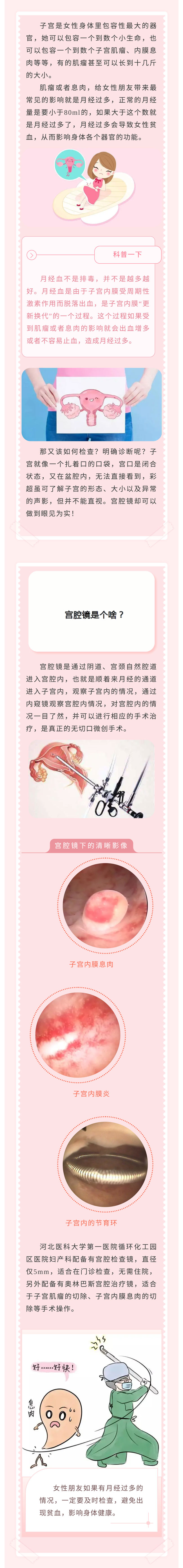 月經(jīng)量增多！怎么回事？——小小“宮腔鏡”，一探究竟！.jpg